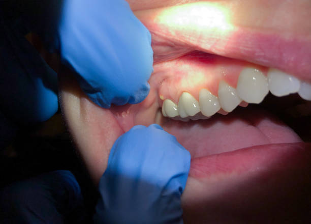 Best Orthodontic Emergency Dentist in Mayo, FL