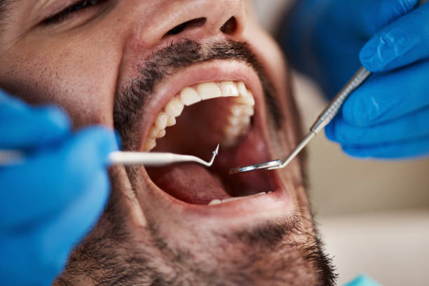 Best Mobile Emergency Dentist in Mayo, FL